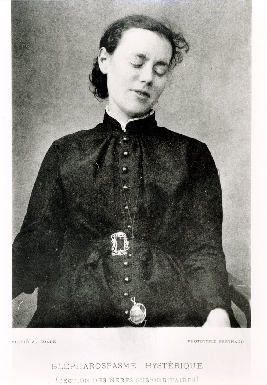 Tahaton blefarospasmi, professori Jean Martin Charcotin (1825-1893) teoksesta Nouvelle Iconographie de la Salpetriere, julkaistu Pariisissa, 1889 tekijältä Albert Londe