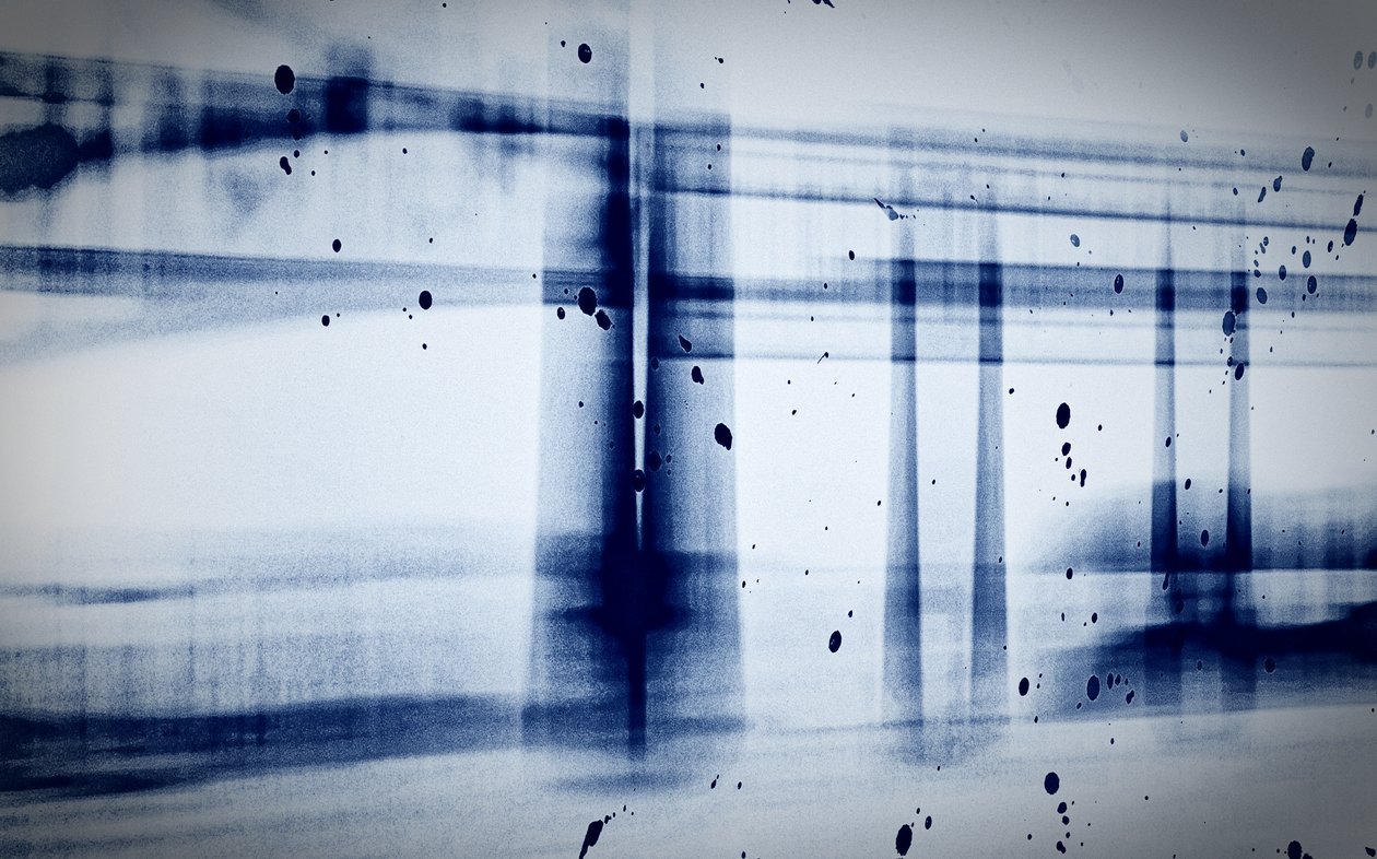 Lumi (röntgen), 2019, (valokuvaus) tekijältä Alex Caminker