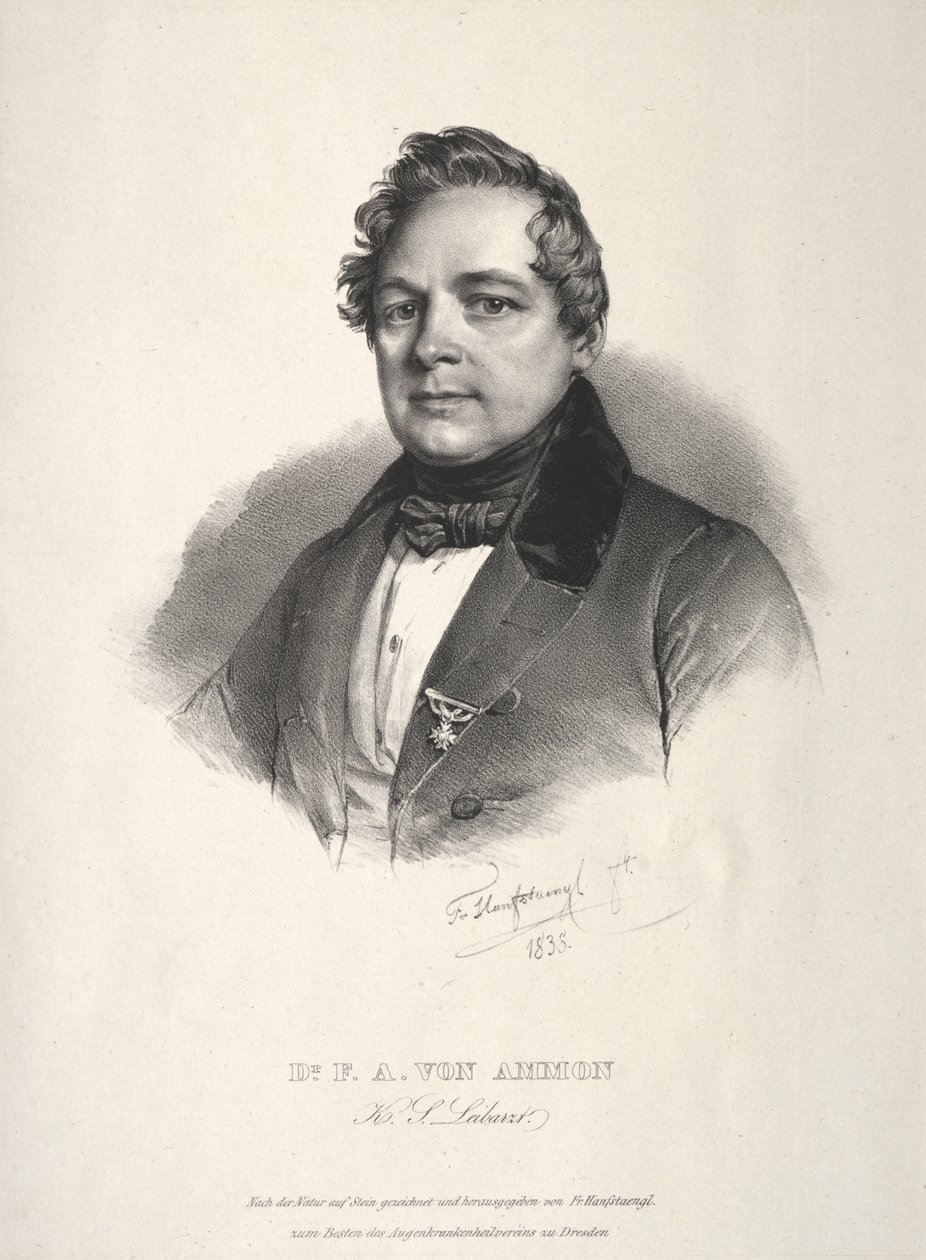 DR Frederick Augustus Ammonista tekijältä Franz Seraph Hanfstaengl