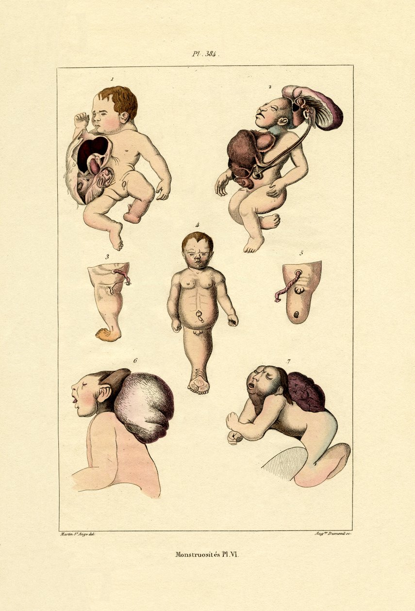 Freak, 1833-39 tekijältä French School