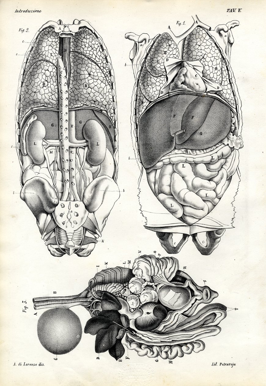 Intestines, 1863-79 tekijältä Raimundo Petraroja