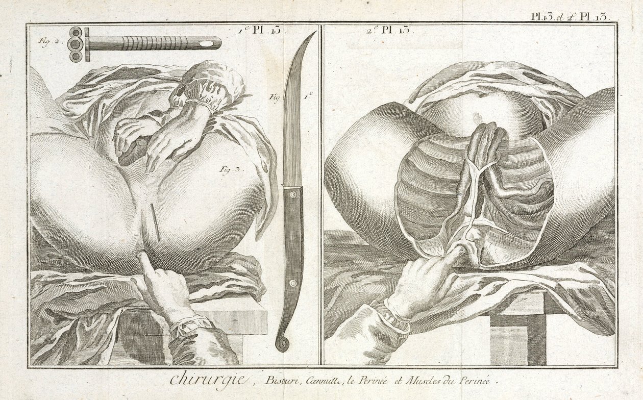Varusteet, Early-Modern tekijältä Unbekannt