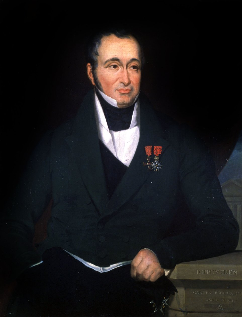 Tohtori Dupuytren, n.1820 (maalaus) tekijältä Unbekannter Künstler
