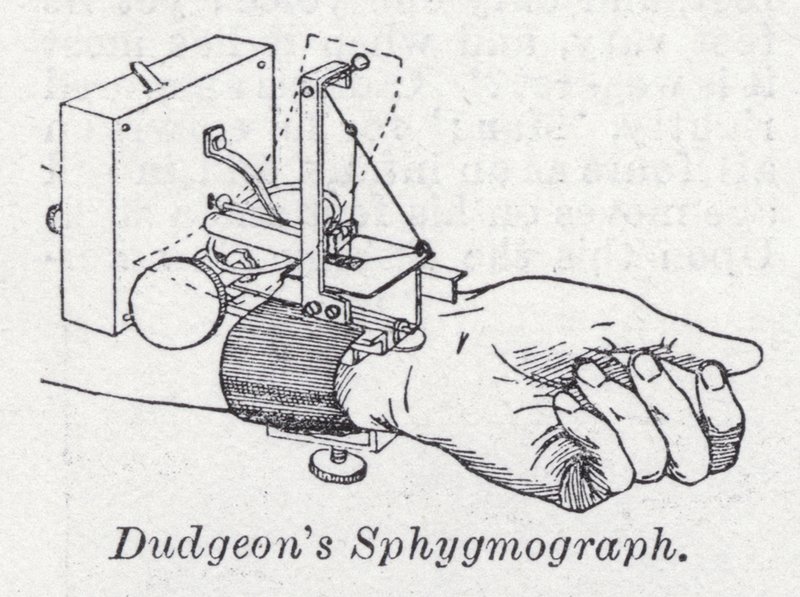 Dudgeonin sfygmografi (litho) tekijältä English School