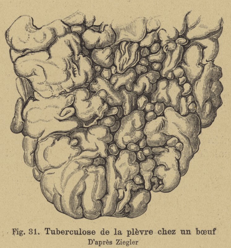 Naudan tuberkuloosi tekijältä German School